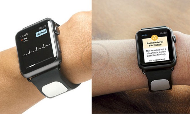 IOS Heart Monitoring App By Kardia For iWatch Gets Approval From Gundrota