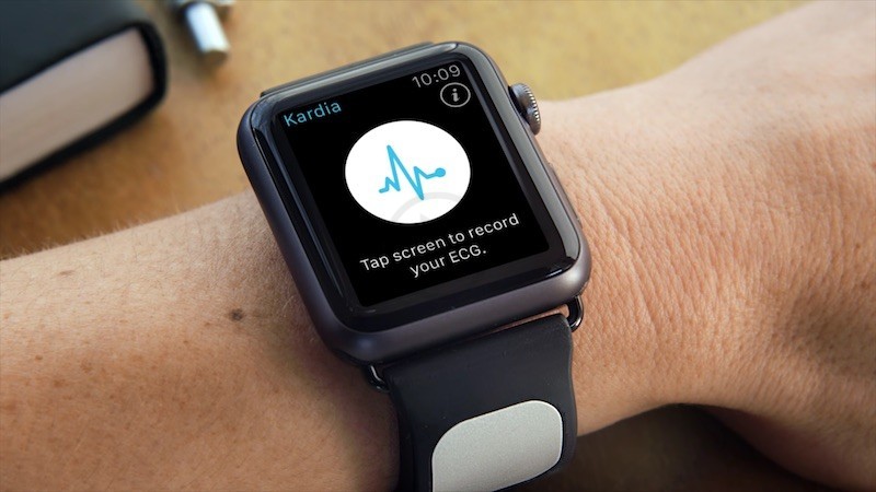 AliveCor Confirms That ‘Kardia Band’ The Apple Watch Is Capable Of Medical Grade EKG Analysis