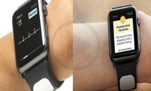 IOS Heart Monitoring App By Kardia For iWatch Gets Approval From Gundrota