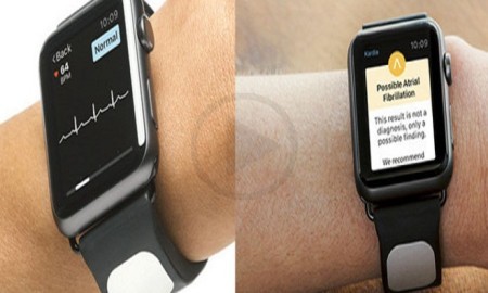 IOS Heart Monitoring App By Kardia For iWatch Gets Approval From Gundrota
