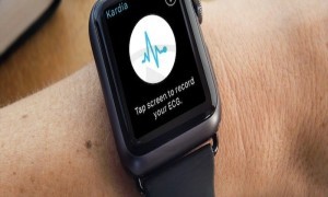 AliveCor Confirms That ‘Kardia Band’ The Apple Watch Is Capable Of Medical Grade EKG Analysis