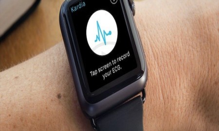 AliveCor Confirms That ‘Kardia Band’ The Apple Watch Is Capable Of Medical Grade EKG Analysis